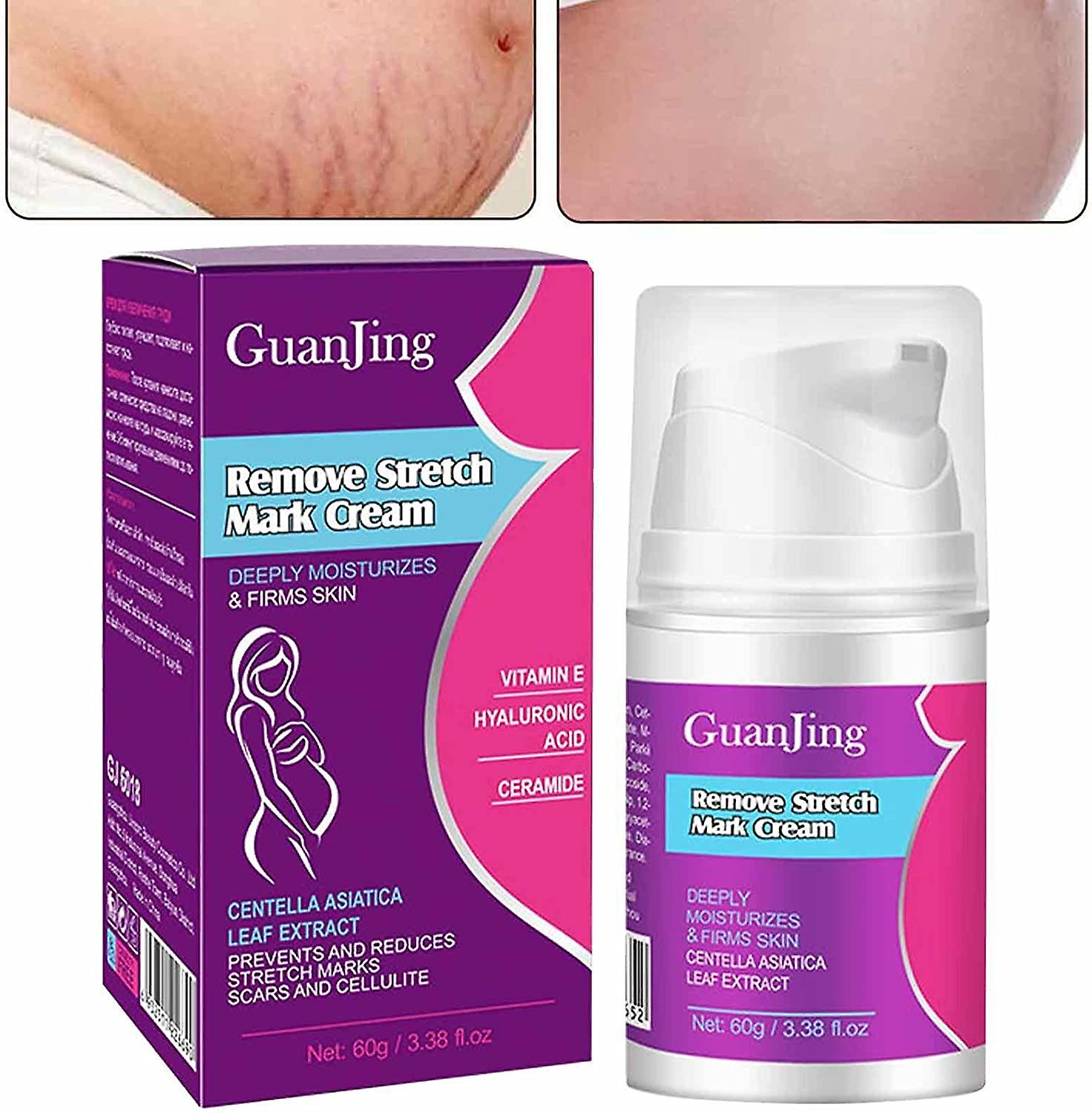 GuanJing Remove Stretch Mark Cream (60gr)